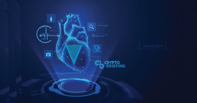 XVG Price Analysis May 20