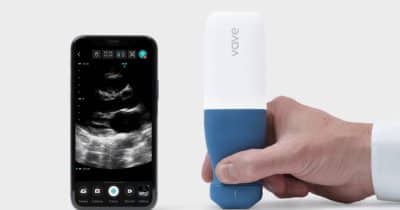 Midjourney unveils first hardware product, an ultrasonic scanner