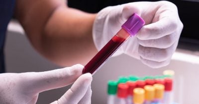 Centrifuge enables deSPXA holders to borrow against S&P 500 exposure on Morpho